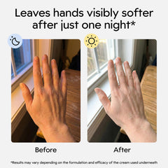 Clearbody Organics hypoallergenic gloves protect cracked hands with breathable fabric