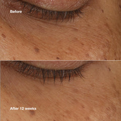 Close-up of Clinique All About Eyes Serum Swirl on skin for smoothness.