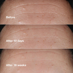 Packaging box of Clinique Smart Clinical Repair serum for a clinical look.
