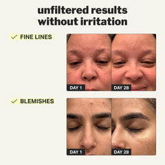 Illustration of the Tri-Retinoid Comfort Complex supporting calm retinol use.