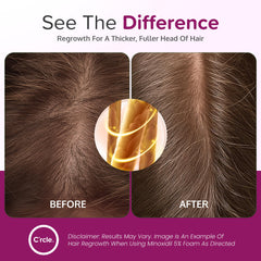 C'rcle foam on top scalp demonstrates precise, mess-free application.