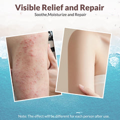 Crogooe crema eczema con aloe vera, sensación refrescante y alivio suave.