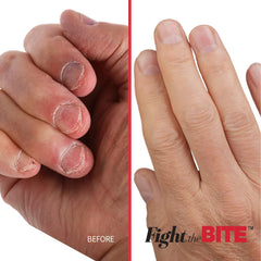 Cuccio Fight The Bite nail swatch displays invisible finish on natural nails.