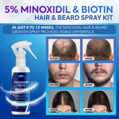 DABIDA Minoxidil spray aplicación diaria para estimular crecimiento capilar