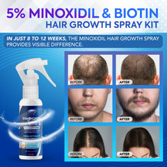 DABIDA Minoxidil spray dispensing for even coverage on thinning areas