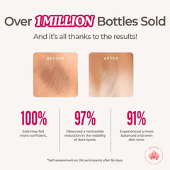 Application on skin using Dear Kitty Dark Spot Cream to help even tone.
