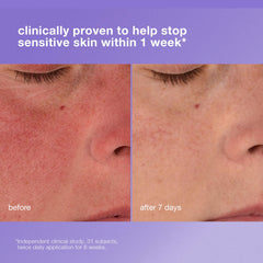 Dermalogica Stabilizing Repair Cream texture close-up reveals balmy hydration for redness-prone skin.