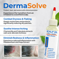 Dermasolve psoriasis oil ingredient display on label