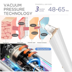 DIYthinker Blackhead Remover Vacuum probes setup highlights versatile cleaning of pores.