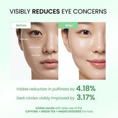 Rodillo 360° de Dongyu para absorción suave y masaje relajante