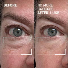 Dr. Brandt Needles No More Baggage warming with fingertips for gentle absorption.