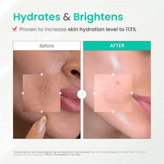 Dr.G Brightening Peeling Gel incluye ácido hialurónico para hidratación ligera