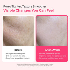 Dr.Melaxin Cemenrete Cyano Pink Serum textura de espículas sugiere renovación suave.