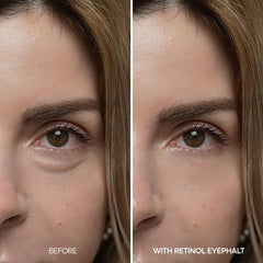 Dr.Melaxin Retinol Eyebag Cream under-eye application shows smooth spread without tugging.