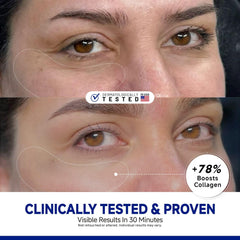 Dr Vincent peptide under-eye patches grip texture closeup demonstrates secure wear.