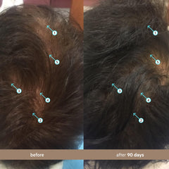 DS Labs Spectral Men’s Hair Density Serum massaged into the scalp.