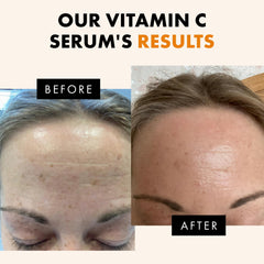 Eclat Skincare Vitamin C Serum ingredient panel highlights ferulic acid
