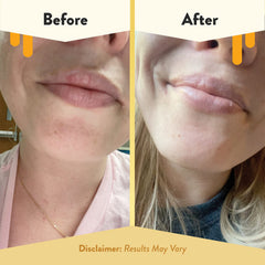 Mango butter and beeswax ingredients in Eczema Honey balm