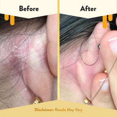 ECZEMA HONEY textura ligera y aplicación suave