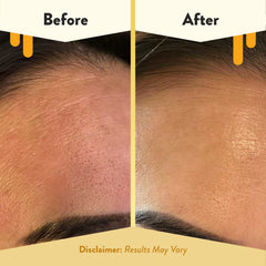 ECZEMA HONEY textura-suave: cuidado delicado para piel sensible.