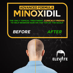 Elevate Minoxidil, spray de textura ligera para peinar sin residuo