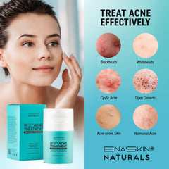 Aplicación en rostro de Enaskin Naturals para manejo de brotes.
