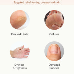 Epielle foot mask worn on feet highlights crack-prone heel relief and softness