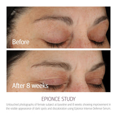 Epionce Intense Defense Serum texture swirled on skin for absorption.