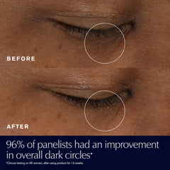 Estée Lauder Advanced Night Repair Eye application closeup demonstrating quick absorption