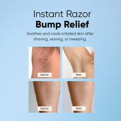 ESTETIST Razor Bump Roll-On cooling effect for post-shave comfort