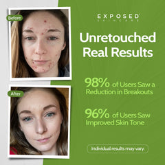 Exposed Skin Care Tónico: poros visibles y control de grasa durante el día.