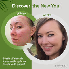 Exposed Skin Care Tónico: textura sedosa al aplicar para sensación fresca.