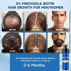 Felicemy Minoxidil crecimiento pelo para estimular folículos y densidad.