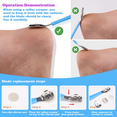 FINTOZER scraper for efficient callus removal and cleansing