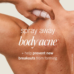 First Aid Beauty Body Acne Spray botella clara para ver la cantidad de producto