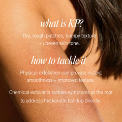 Label of First Aid Beauty KP Bump Eraser shows 10% AHA for renewal.