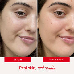 First Aid Beauty Ultra Repair applied in morning routine, lightweight hydrator for all-day comfort.