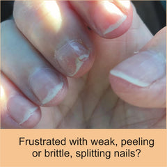 FlexiNail nails undergoing treatment for stronger, less peeling nails.