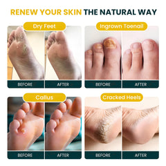 Foot Cure desintoxicacion: aroma cítrico para spa de pies en casa.
