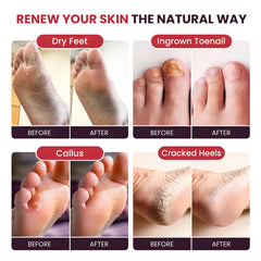 Foot Cure: pies refrescados tras un baño que revitaliza la piel y el ánimo.
