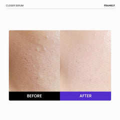 FRANKLY Closer Serum texture swatch reveals creamy serum ready for daily use