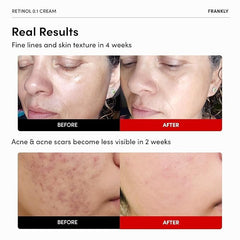 FRANKLY Retinol 0.1% crema, textura cremosa suave, facilita hidratación profunda.