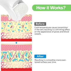 Fronnor Ice Roller jawline; provides a cooling contour and relief.