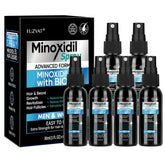 FUZYAT 5% Minoxidil spray bottle for men and women supports hair vitality.