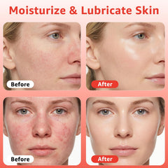 Fymiox serum luz roja: gotero para aplicación suave y precisa.