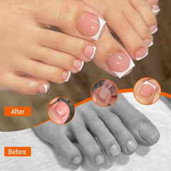 GELLAKTIK toe forms with non-stick surface allow easy removal after curing