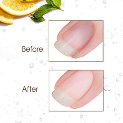 Gena Nail Brite nails with visible discoloration before whitening