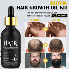 Suero de biotina para cabello, fortalece y revitaliza.