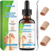 GIFBEA Ingrown Toenail Drops reliever bottle close-up for soothing, easier nail care.