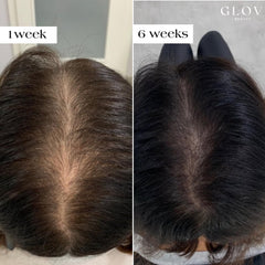 Glov Beauty peptide serum ampoules deliver 5ml each for nourishing scalp hydration.